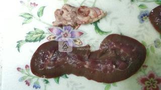 Ȼ裺3